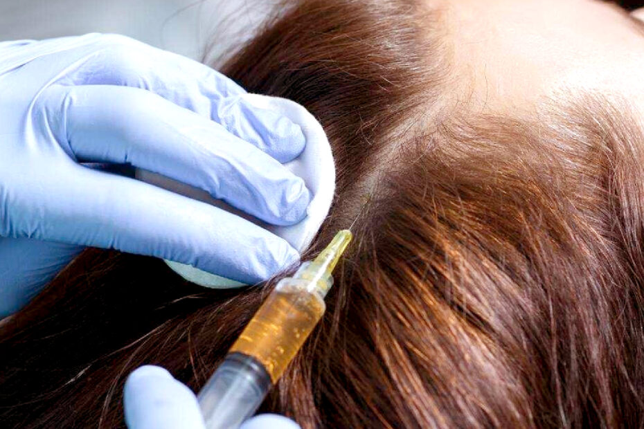 Hair Loss Treatment | Pearl Medical Aesthetics and Laser Center